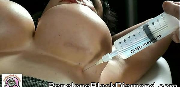  PBD   SklavinMichaela fill up boobs overfill implants expanders